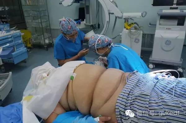 天津医院成功治愈重度肥胖的胸椎管狭窄症患者