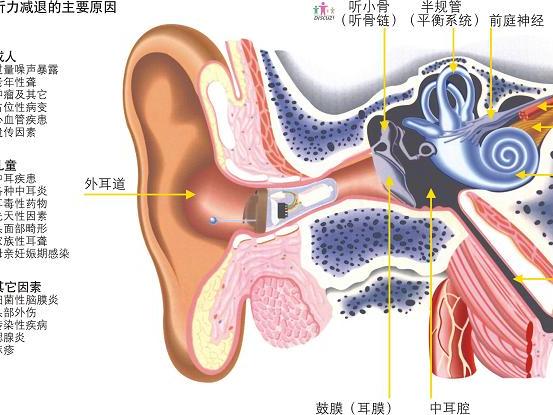 宜兴锦绣菜场杰闻听力：耳聋的治疗与康复方法