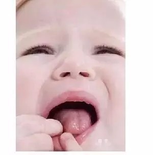 舌诊：宝宝的舌头如果是这样的，他肯定是病了