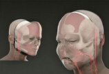 面部移植手术图解