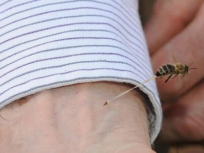 蜜蜂的刺在皮肤上图片图片